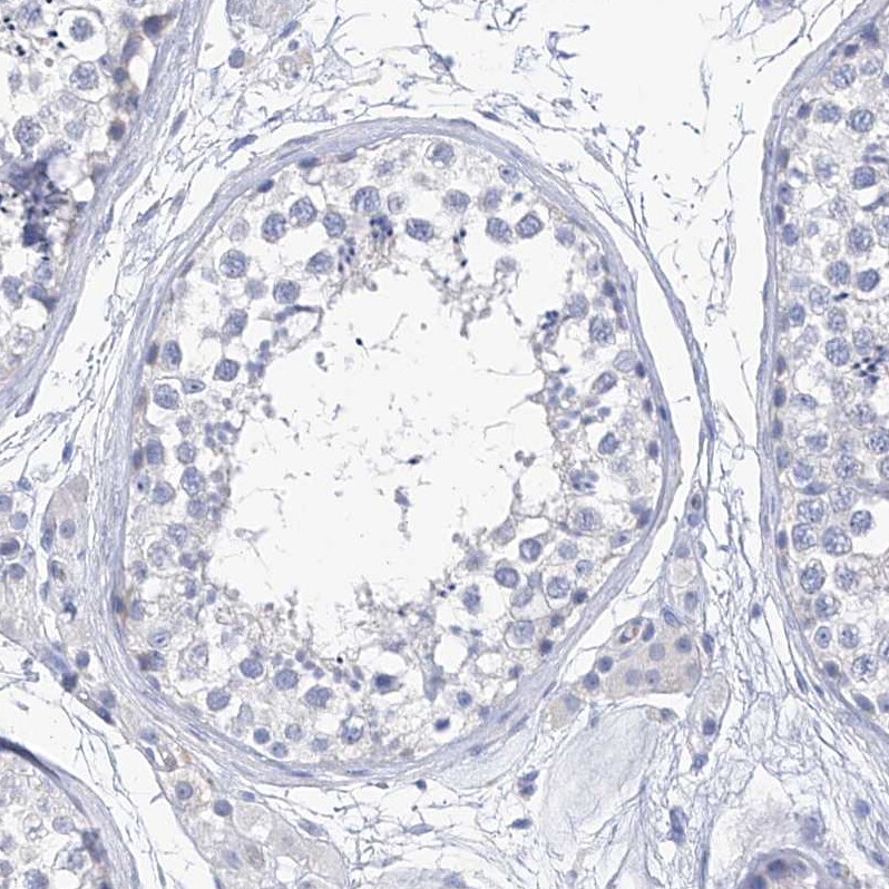 PI 3-Kinase C2 beta Antibody - BSA Free Immunohistochemistry-Paraffin: PI 3-Kinase C2 beta Antibody - BSA Free [NBP1-86795]
