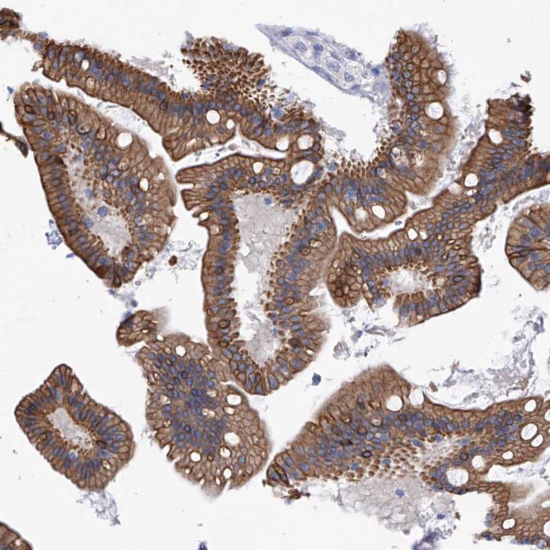 PI 3-Kinase C2 beta Antibody - BSA Free Immunohistochemistry-Paraffin: PI 3-Kinase C2 beta Antibody - BSA Free [NBP1-86795]