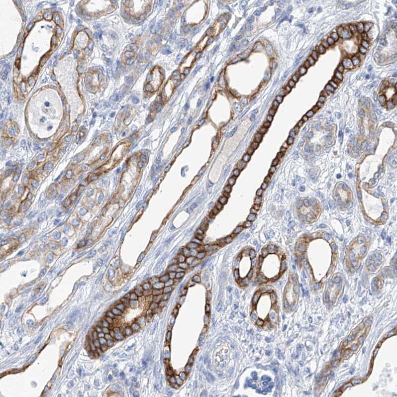 PI 3-Kinase C2 beta Antibody - BSA Free Immunohistochemistry-Paraffin: PI 3-Kinase C2 beta Antibody - BSA Free [NBP1-86795]