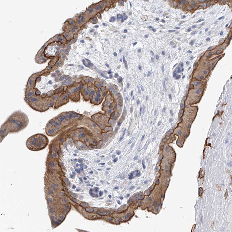 PI 3-Kinase C2 beta Antibody - BSA Free Immunohistochemistry-Paraffin: PI 3-Kinase C2 beta Antibody - BSA Free [NBP1-86795]