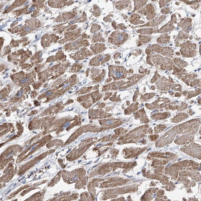 COMMD1 Antibody - BSA Free Immunohistochemistry: COMMD1 Antibody - BSA Free [NBP1-86797]