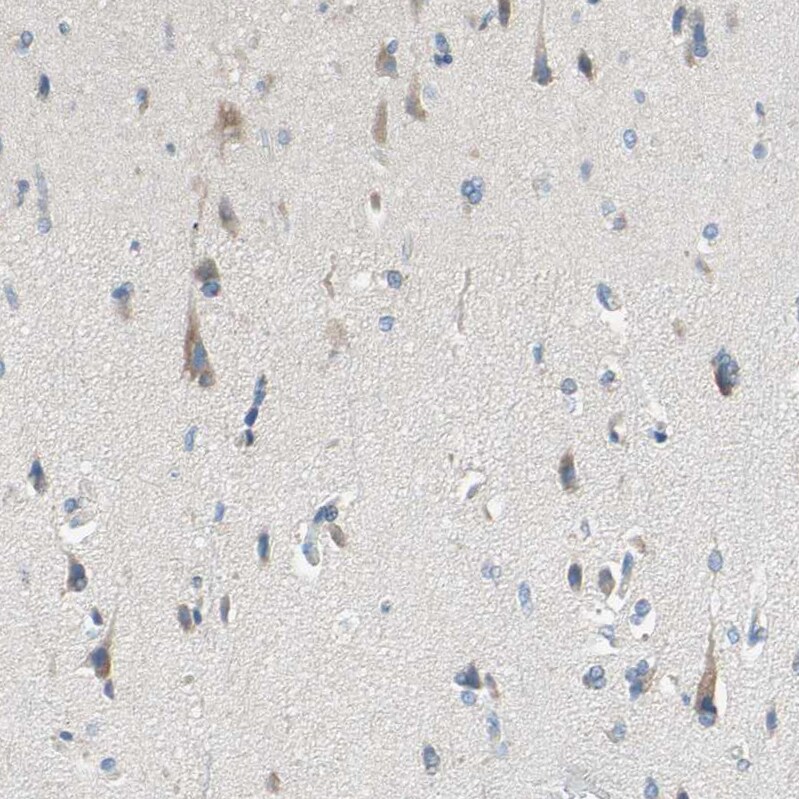 MFF Antibody - BSA Free Immunohistochemistry-Paraffin: MFF Antibody - BSA Free [NBP1-86799]