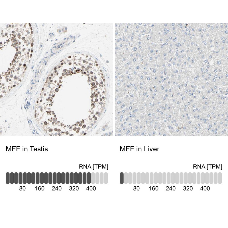MFF Antibody - BSA Free Immunohistochemistry-Paraffin: MFF Antibody - BSA Free [NBP1-86799]
