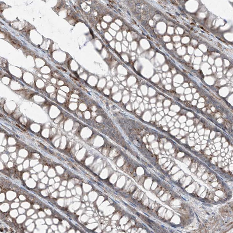 ERLEC1 Antibody - BSA Free Immunohistochemistry-Paraffin: ERLEC1 Antibody - BSA Free [NBP1-86801]