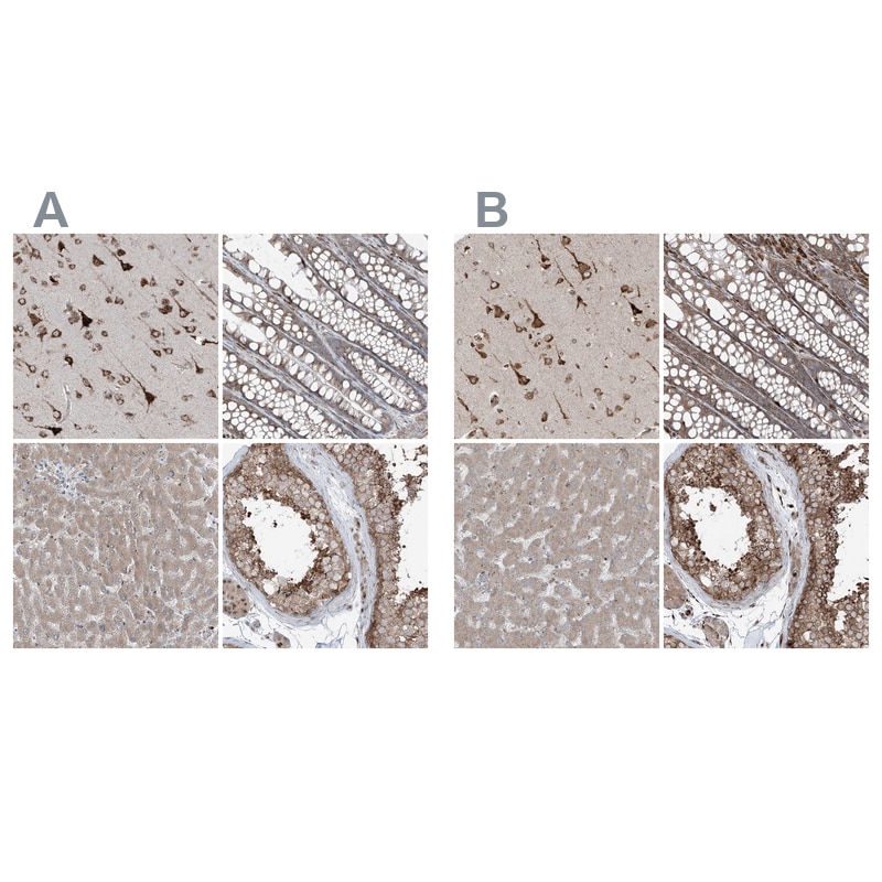 ERLEC1 Antibody - BSA Free Immunohistochemistry-Paraffin: ERLEC1 Antibody - BSA Free [NBP1-86801]