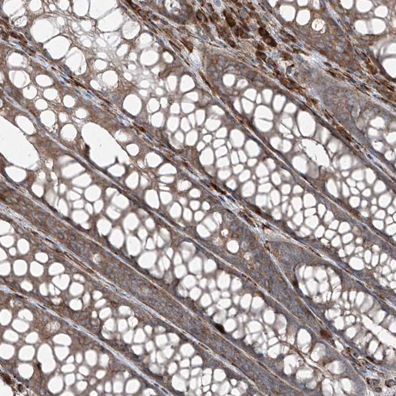 ERLEC1 Antibody - BSA Free Immunohistochemistry-Paraffin: ERLEC1 Antibody - BSA Free [NBP1-86802]