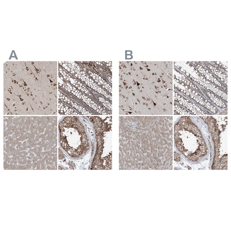 ERLEC1 Antibody - BSA Free Immunohistochemistry-Paraffin: ERLEC1 Antibody - BSA Free [NBP1-86802]