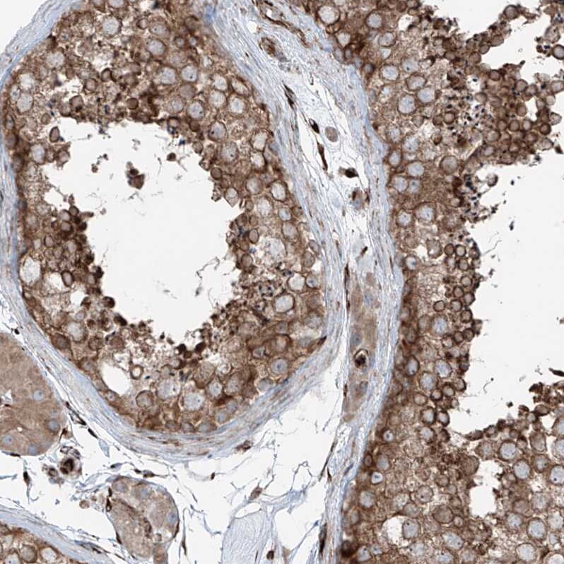 ERLEC1 Antibody - BSA Free Immunohistochemistry-Paraffin: ERLEC1 Antibody - BSA Free [NBP1-86802]