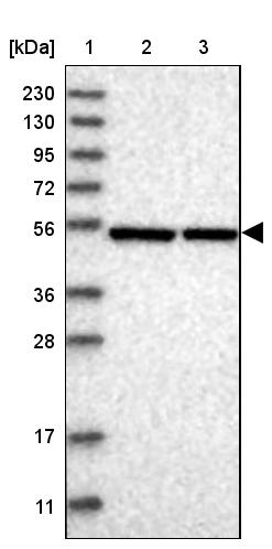 ERLEC1 Antibody - BSA Free Western Blot: ERLEC1 Antibody - BSA Free [NBP1-86802]