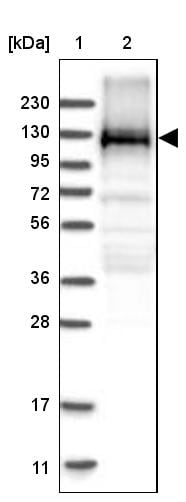 EML4 Antibody - BSA Free Western Blot: EML4 Antibody - BSA Free [NBP1-86805]
