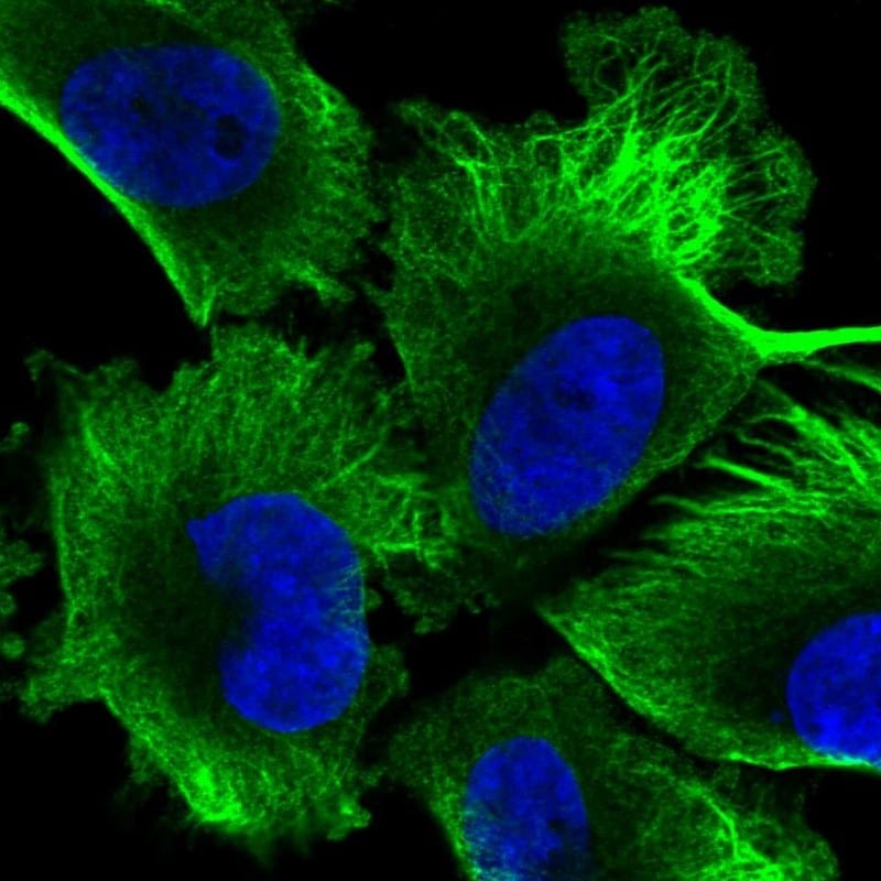 EML4 Antibody - BSA Free Immunohistochemistry-Paraffin: EML4 Antibody - BSA Free [NBP1-86805]