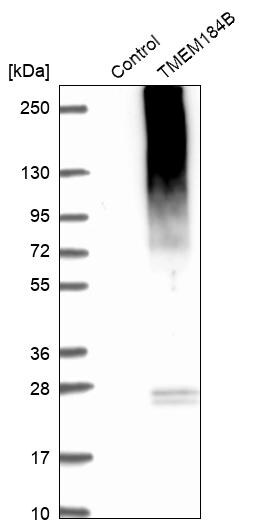 TMEM184B Antibody - BSA Free Western Blot: TMEM184B Antibody - BSA Free [NBP1-86810]