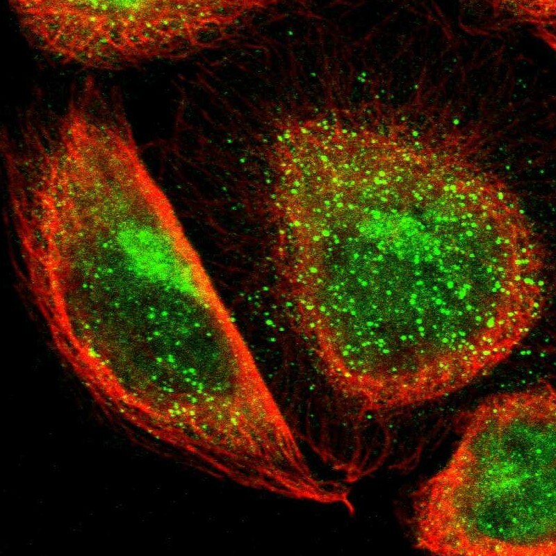 TBC1D22A Antibody - BSA Free Immunocytochemistry/ Immunofluorescence: TBC1D22A Antibody [NBP1-86811]
