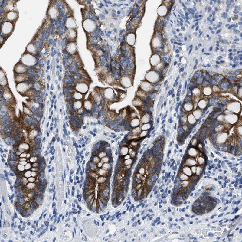 MRPL39 Antibody - BSA Free Immunohistochemistry-Paraffin: MRPL39 Antibody [NBP1-86815]