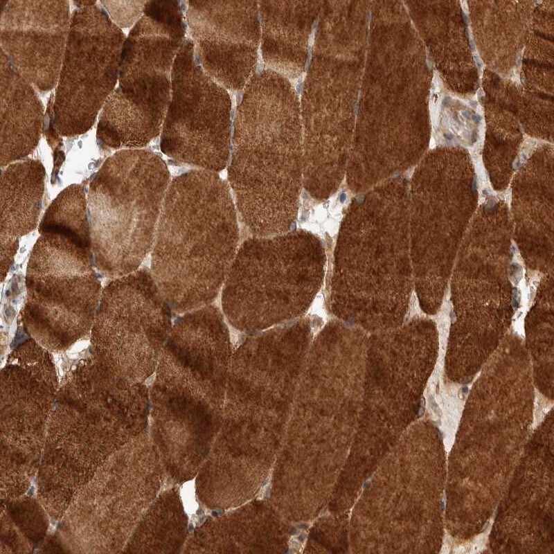 PRDM15 Antibody - BSA Free Immunohistochemistry: PRDM15 Antibody - BSA Free [NBP1-86816]