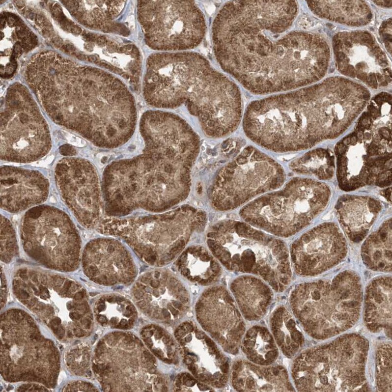 GCFC1 Antibody - BSA Free Immunohistochemistry-Paraffin: GCFC1 Antibody - BSA Free [NBP1-86818]