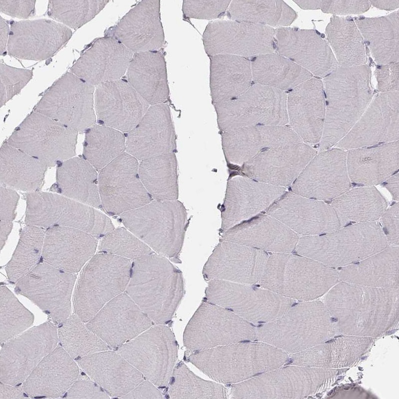 ZP4 Antibody - BSA Free Immunohistochemistry-Paraffin: ZP4 Antibody - BSA Free [NBP1-86823]