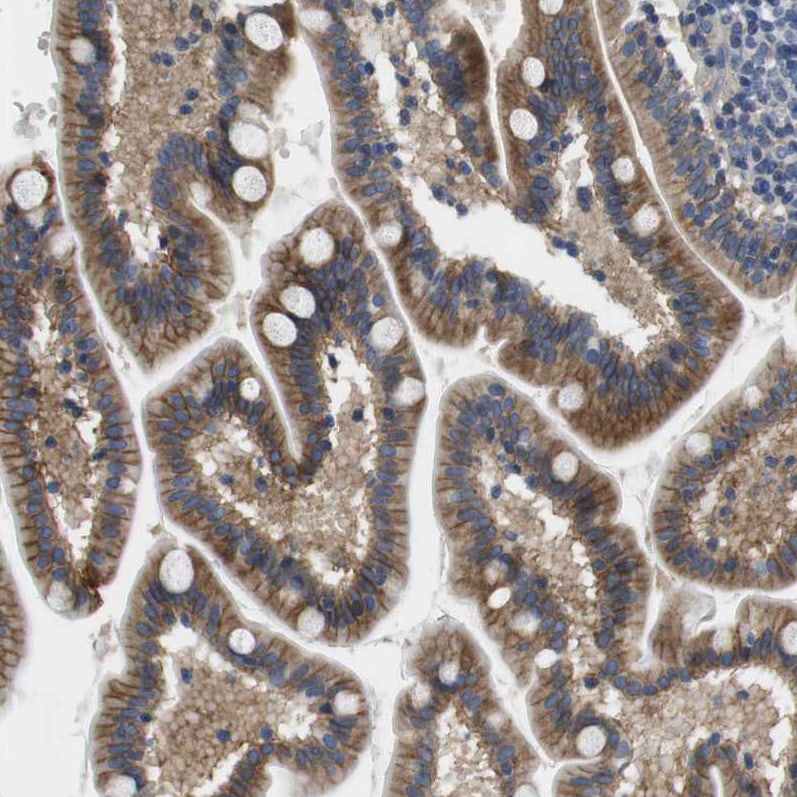 SLC30A1 Antibody - BSA Free Immunohistochemistry-Paraffin: SLC30A1 Antibody - BSA Free [NBP1-86825]