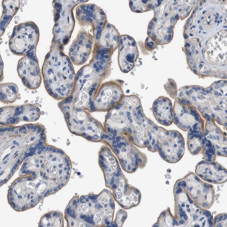 SLC30A1 Antibody - BSA Free Immunohistochemistry-Paraffin: SLC30A1 Antibody - BSA Free [NBP1-86825]