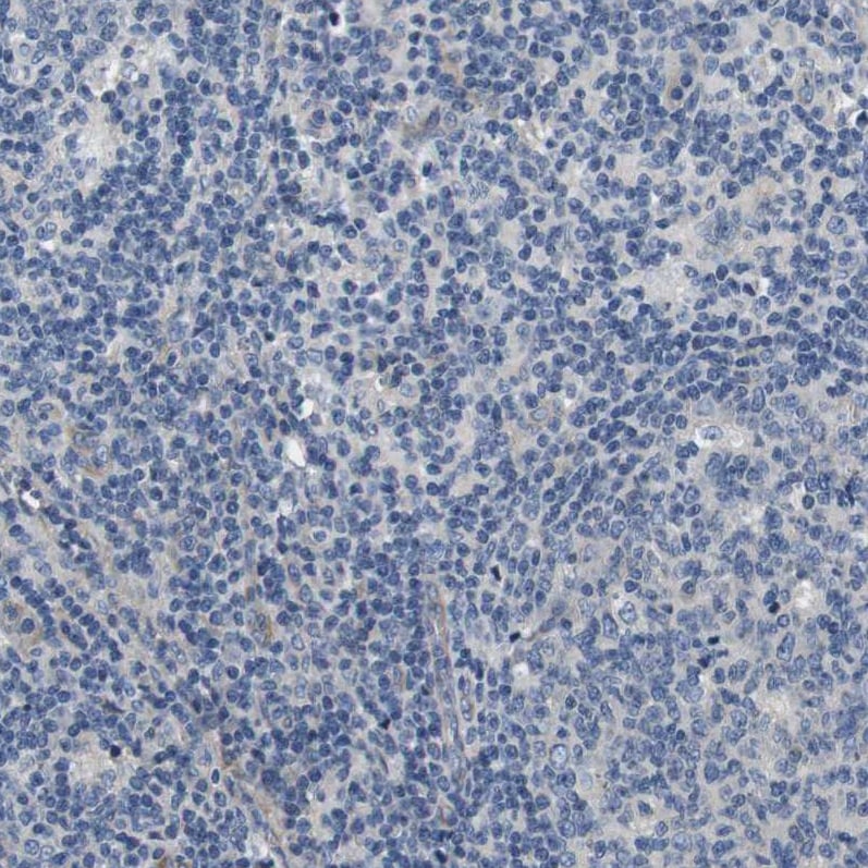SLC30A1 Antibody - BSA Free Immunohistochemistry-Paraffin: SLC30A1 Antibody - BSA Free [NBP1-86825]