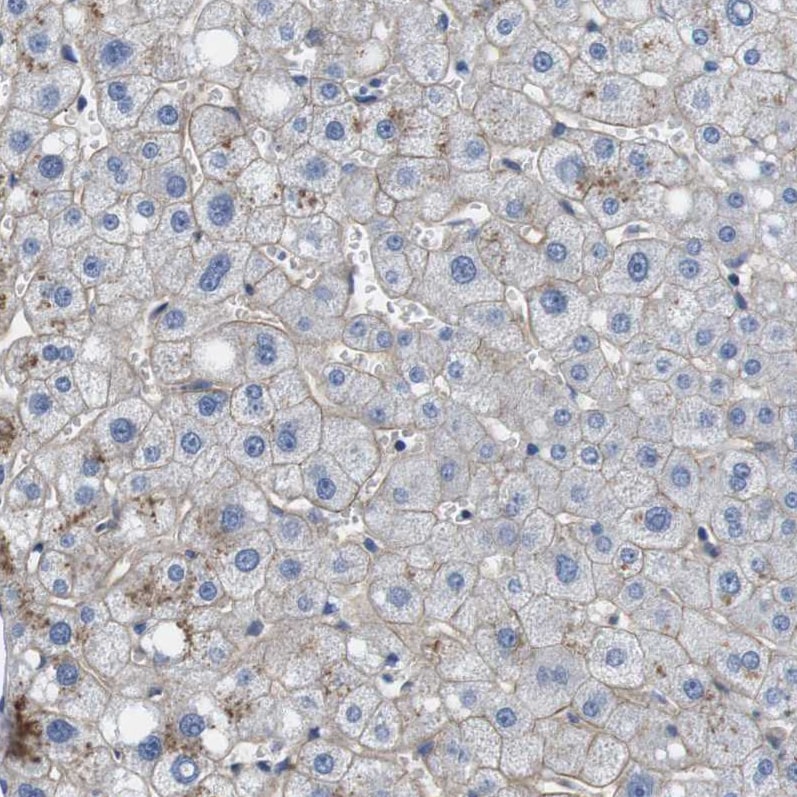 SLC30A1 Antibody - BSA Free Immunohistochemistry-Paraffin: SLC30A1 Antibody - BSA Free [NBP1-86825]