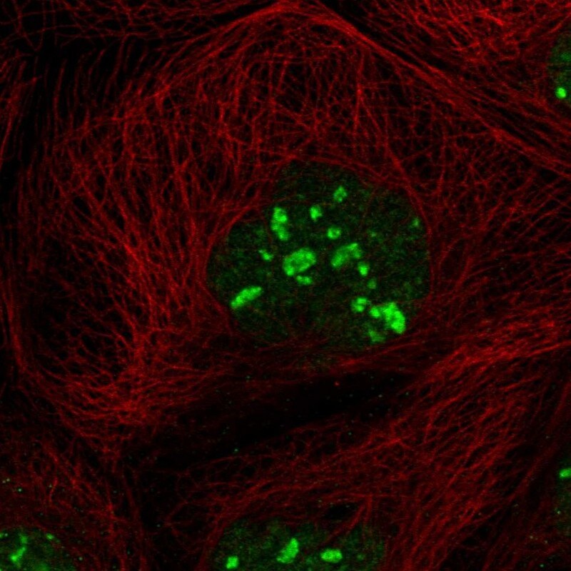 LYAR Antibody - BSA Free Immunocytochemistry/ Immunofluorescence: LYAR Antibody [NBP1-86827]
