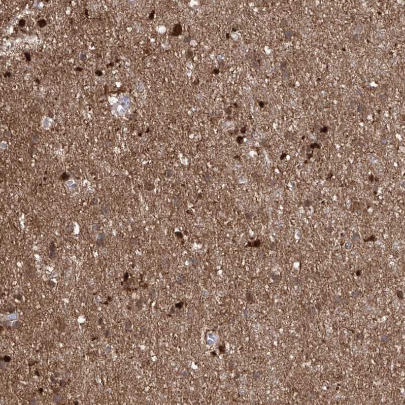 ZNF653 Antibody - BSA Free Immunohistochemistry-Paraffin: ZNF653 Antibody - BSA Free [NBP1-86828]
