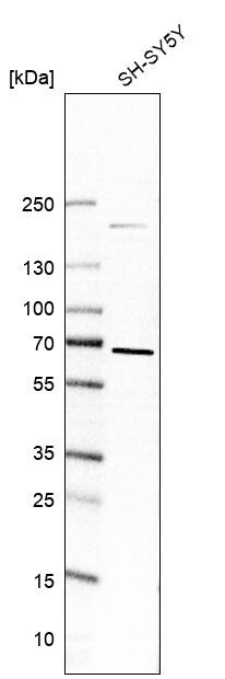 ZNF653 Antibody - BSA Free Western Blot: ZNF653 Antibody - BSA Free [NBP1-86828]