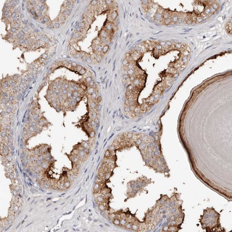 SLC39A2/ZIP2 Antibody - BSA Free Immunohistochemistry: SLC39A2/ZIP2 Antibody - BSA Free [NBP1-86830]