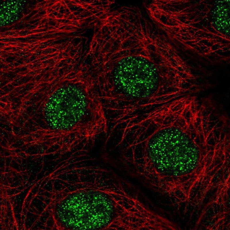 ZIC1 Antibody - BSA Free Immunocytochemistry/ Immunofluorescence: ZIC1 Antibody [NBP1-86833]