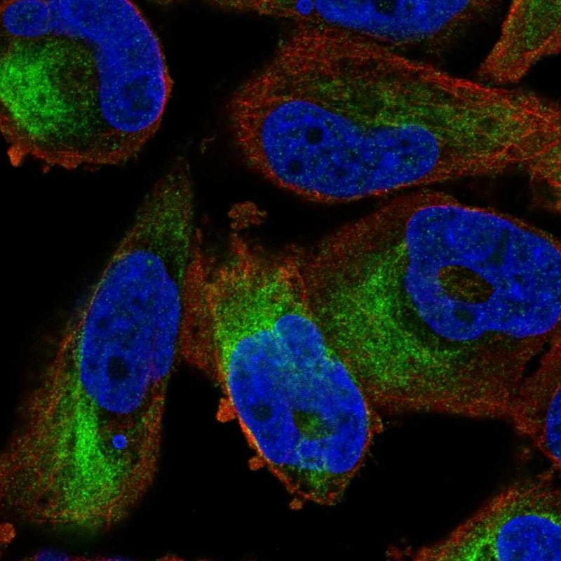 ZFP95 Antibody - BSA Free Immunocytochemistry/ Immunofluorescence: ZFP95 Antibody [NBP1-86834]