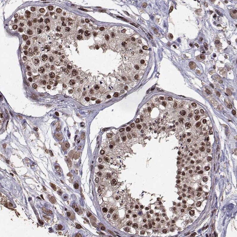 Splicing Factor 1 Antibody - BSA Free Immunohistochemistry-Paraffin: Splicing Factor 1 Antibody [NBP1-86835]