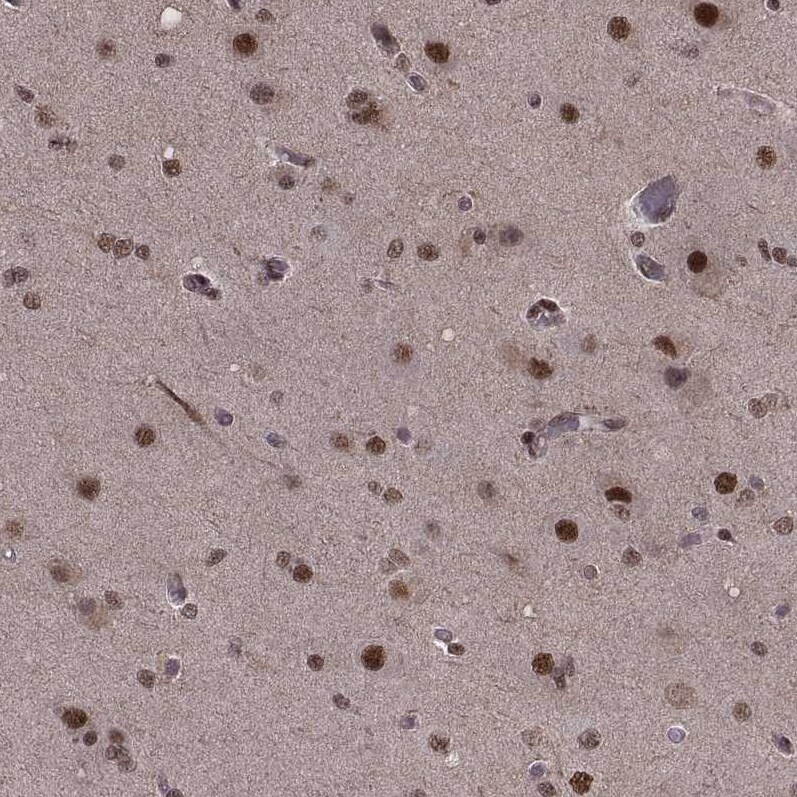 Splicing Factor 1 Antibody - BSA Free Immunohistochemistry-Paraffin: Splicing Factor 1 Antibody [NBP1-86835]