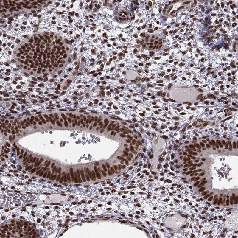 Splicing Factor 1 Antibody - BSA Free Immunohistochemistry-Paraffin: Splicing Factor 1 Antibody [NBP1-86835]