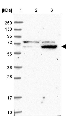 ZNF324 Antibody - BSA Free Western Blot: ZNF324 Antibody - BSA Free [NBP1-86836]