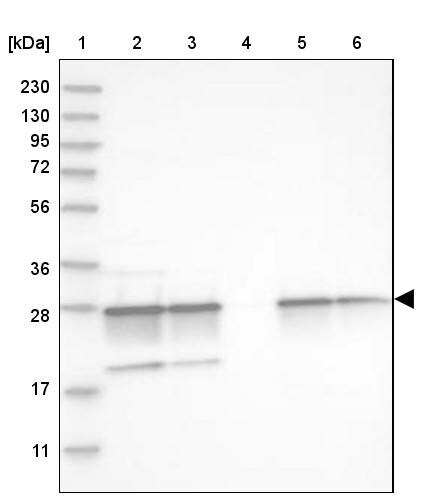 Proteasome 20S alpha 5 Antibody - BSA Free Western Blot: Proteasome 20S alpha 5 Antibody - BSA Free [NBP1-86838]