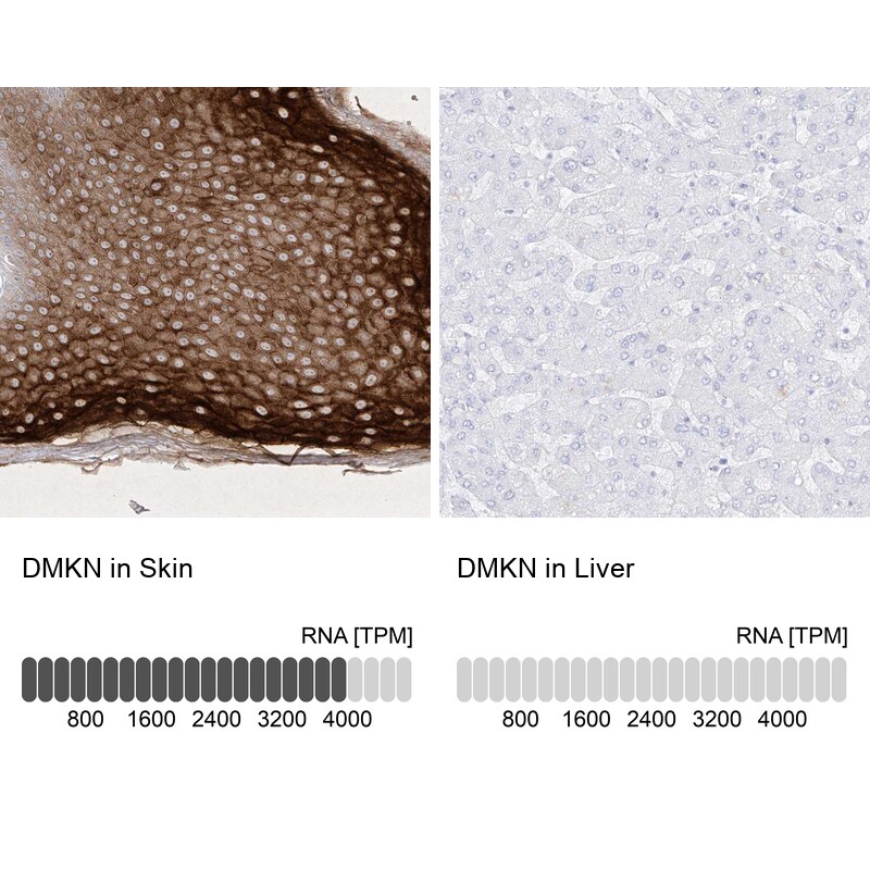 Dermokine beta Antibody - BSA Free Immunohistochemistry-Paraffin: Dermokine beta Antibody - BSA Free [NBP1-86840]