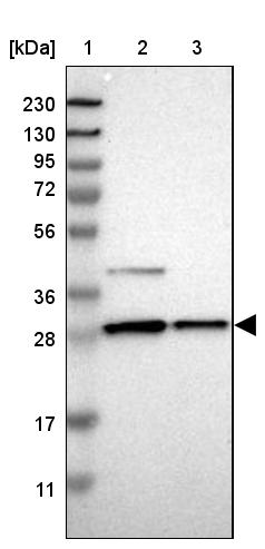 ZAG Antibody - BSA Free Western Blot: ZAG Antibody - BSA Free [NBP1-86842]