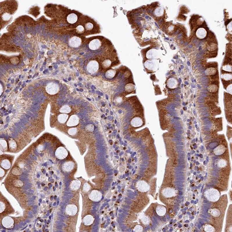 LSM4 Antibody - BSA Free Immunohistochemistry-Paraffin: LSM4 Antibody [NBP1-86846]