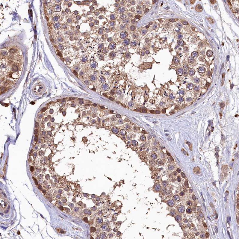 LSM4 Antibody - BSA Free Immunohistochemistry-Paraffin: LSM4 Antibody [NBP1-86846]
