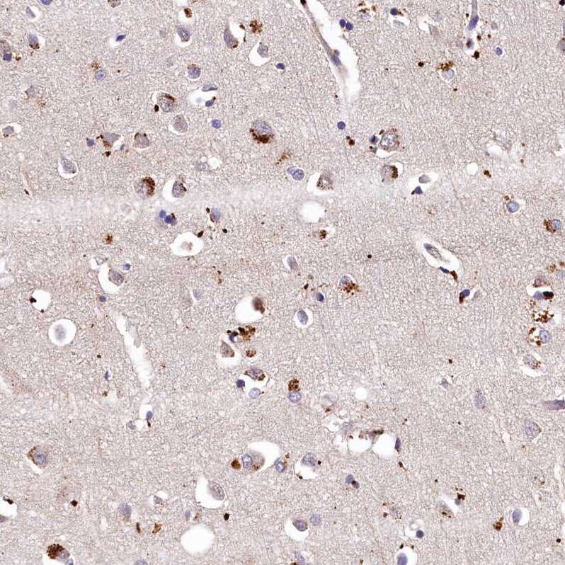 LSM4 Antibody - BSA Free Immunohistochemistry-Paraffin: LSM4 Antibody [NBP1-86846]