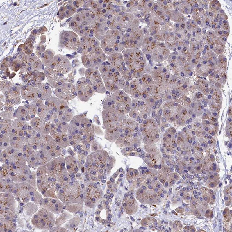 LSM4 Antibody - BSA Free Immunohistochemistry-Paraffin: LSM4 Antibody - BSA Free [NBP1-86846]