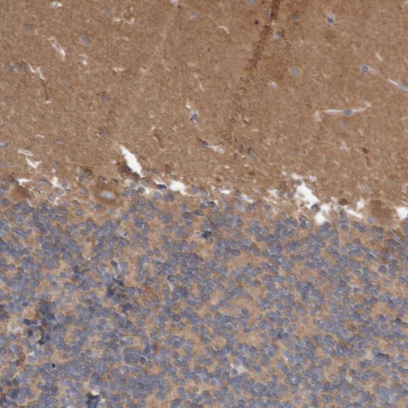 ANKK1 Antibody - BSA Free Immunohistochemistry-Paraffin: ANKK1 Antibody - BSA Free [NBP1-86849]