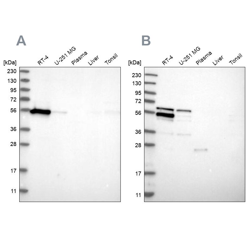 WIRE Antibody - BSA Free Western Blot: WIRE Antibody - BSA Free [NBP1-86856]