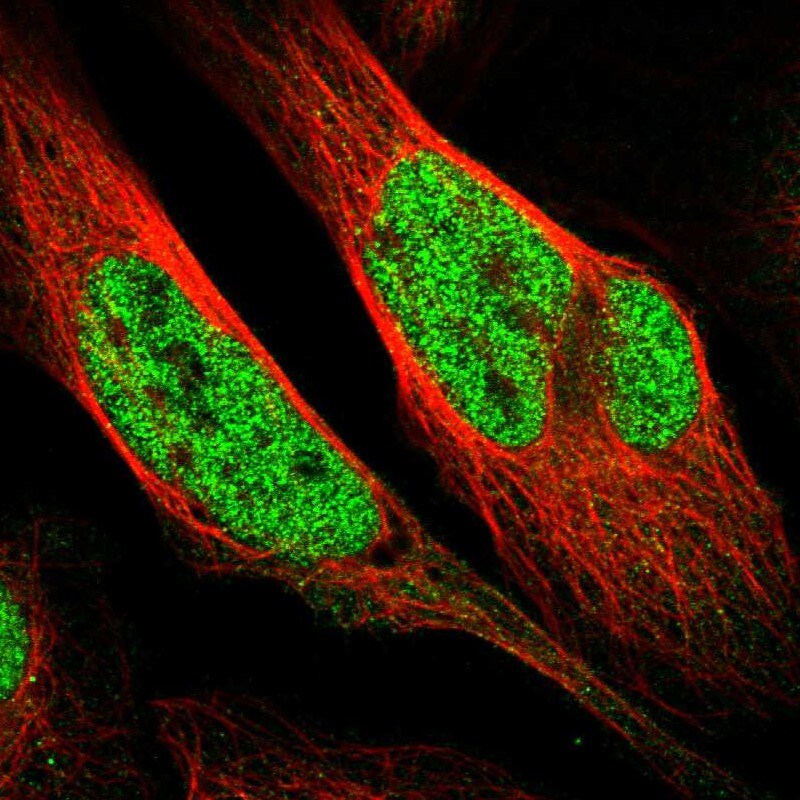 WIRE Antibody - BSA Free Immunohistochemistry-Paraffin: WIRE Antibody - BSA Free [NBP1-86858]