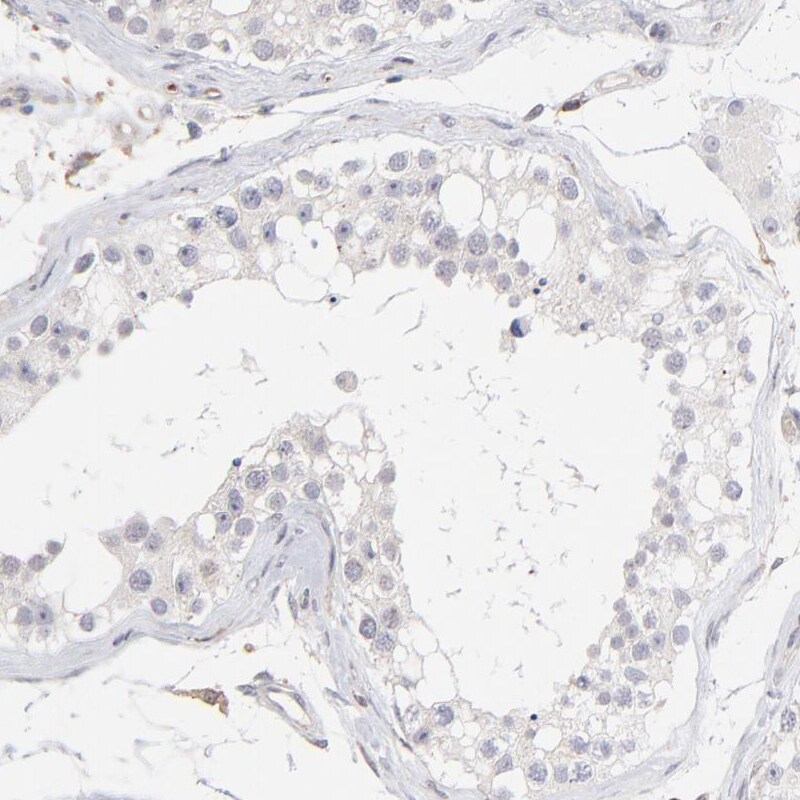 WIPF1/WIP Antibody - BSA Free Immunohistochemistry-Paraffin: WIPF1/WIP Antibody - BSA Free [NBP1-86859]