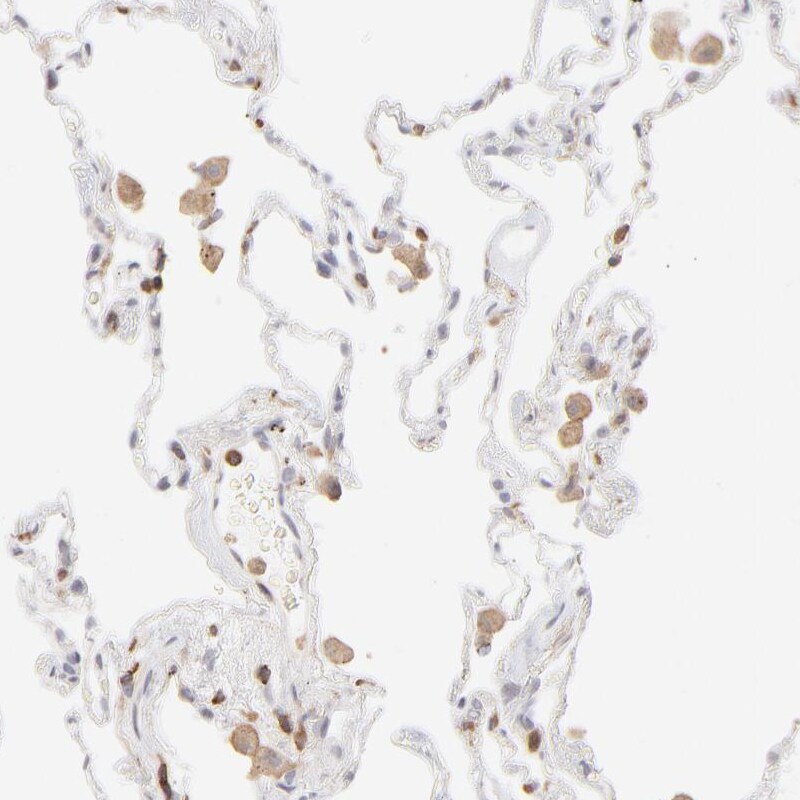 WIPF1/WIP Antibody - BSA Free Immunohistochemistry-Paraffin: WIPF1/WIP Antibody - BSA Free [NBP1-86859]