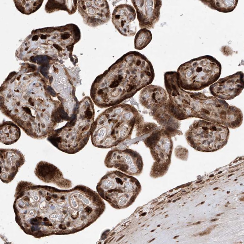 LATS1 Antibody - BSA Free Immunohistochemistry-Paraffin: LATS1 Antibody [NBP1-86860]