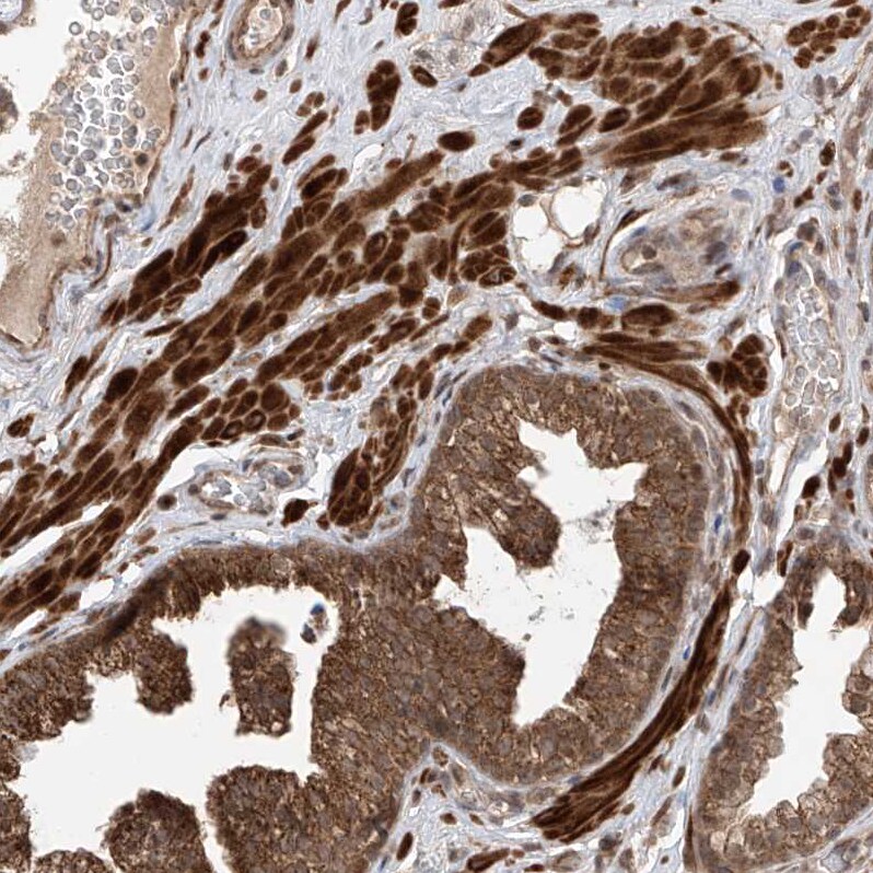 LATS1 Antibody - BSA Free Immunohistochemistry-Paraffin: LATS1 Antibody [NBP1-86860]
