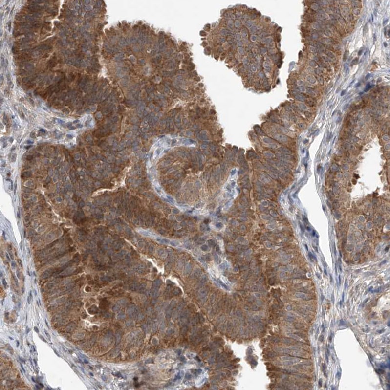 LATS1 Antibody - BSA Free Immunohistochemistry-Paraffin: LATS1 Antibody [NBP1-86860]